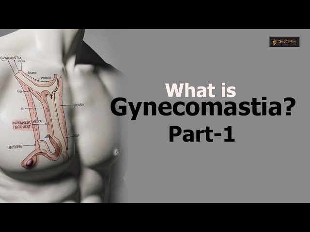 What is Gynecomastia ?? Part1 @gynoguygaurav