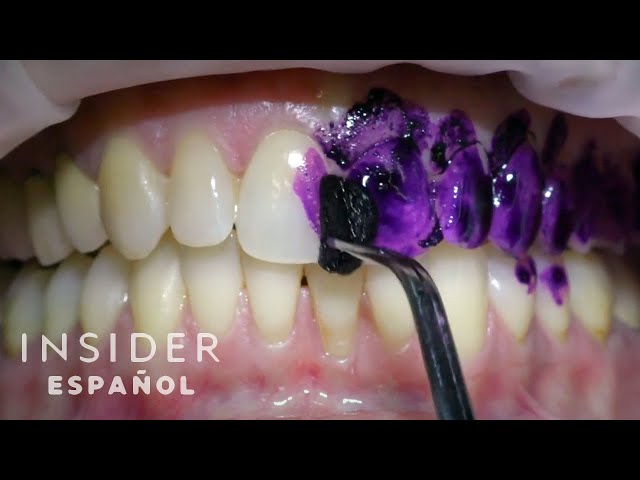 Cómo se hace una limpieza bucal profesional | Limpieza a fondo | Insider Español