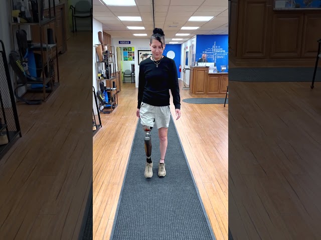 Jeannie’s Latest Prosthetic Setup in Action