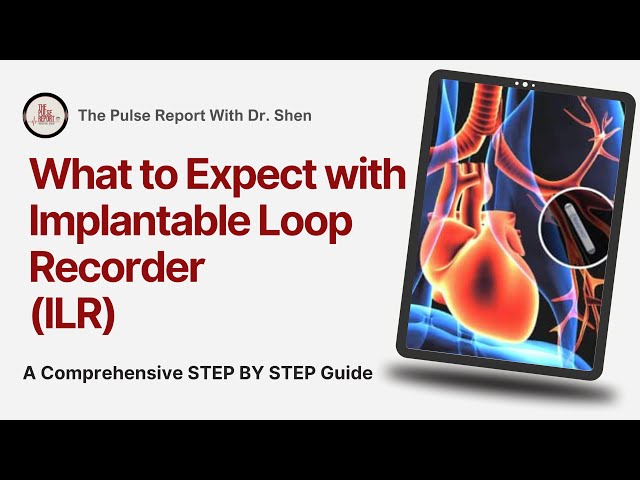 Loop Recorder Implantation Guide for Patients: What to Expect Before, During & After the Procedure