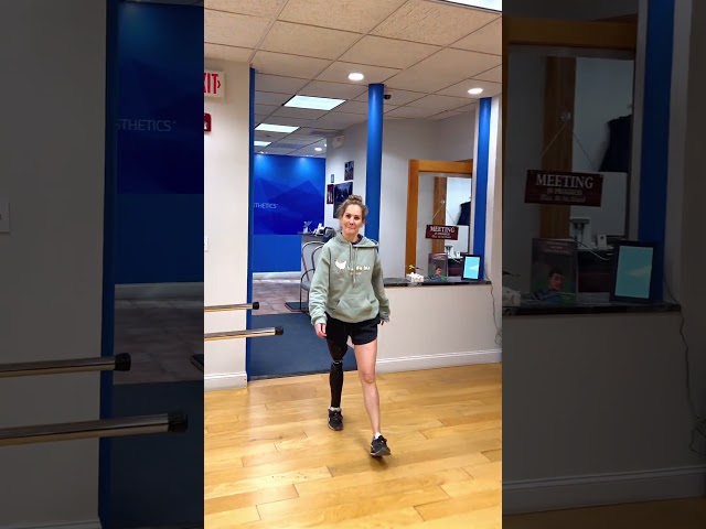 Vicky Walking with an Above-Knee Prosthesis and 3D-Printed Cover