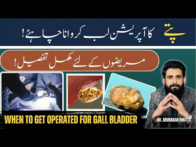 When to Get Operated for Gallbladder Stones? Symptoms, Risks & Surgery Timing Explained