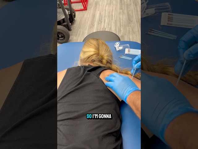 Dry needling is used to treat a variety of issues like neck, shoulder, & back pain  #dryneedling