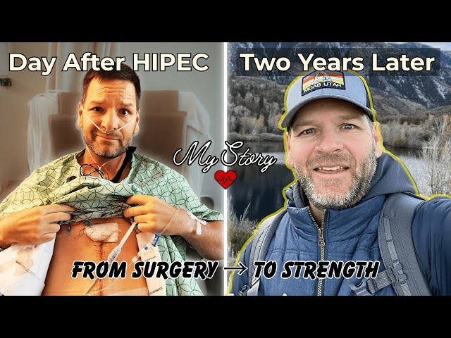 “Life 2 Years After HIPEC Surgery (Appendiceal Cancer / PMP Survivor Update)