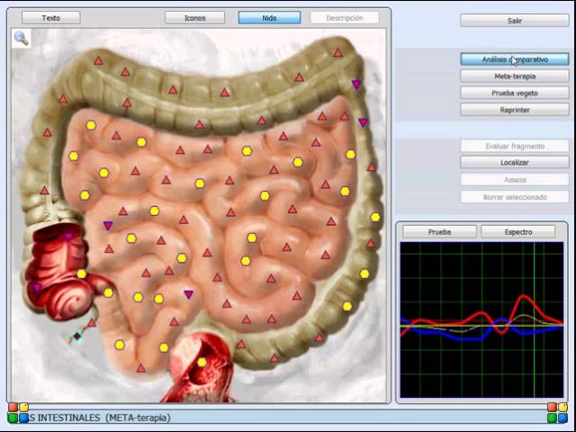 ESCANER MOLECULAR NLS ESPAÑOL DEMO