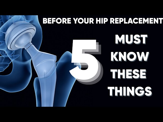 5 Things Every Hip Replacement Patient Must Know.... (After 1000s of Surgeries)
