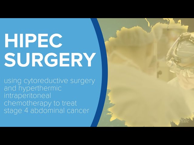 HIPEC Surgery For Abdominal Cancers - Yale Medicine Explains