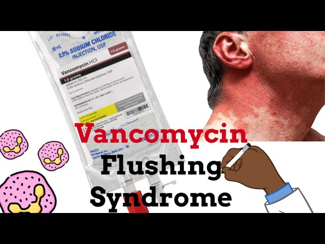 Vancomycin Flushing Syndrome  -  "Redman Syndrome" Quick Explanation