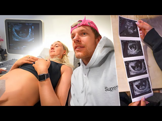 ONZE ALLEREERSTE ECHO!👶🏼 | baby vlog #2