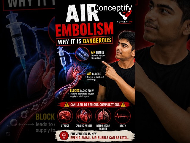 Air embolism #conceptify #viralshorts #trendingshorts #embolism #knowledge