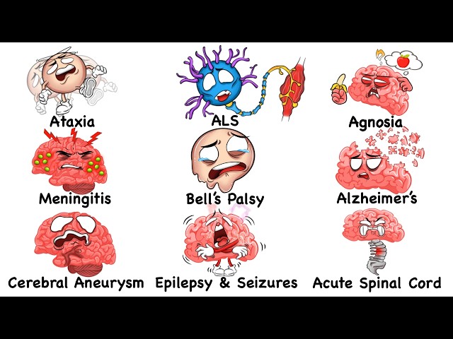 Every Deadly Brain Disorder Explained in 18 Minutes