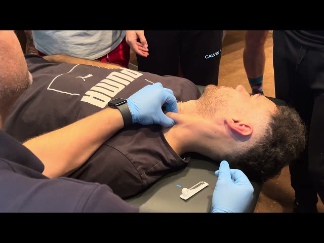 Dry Needling the SCM (Sternocleidomastoid) | Technique, Safety & What Most Clinicians Miss