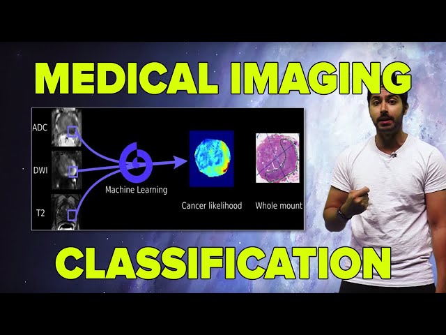 AI in Medicine |  Medical Imaging Classification (TensorFlow Tutorial)