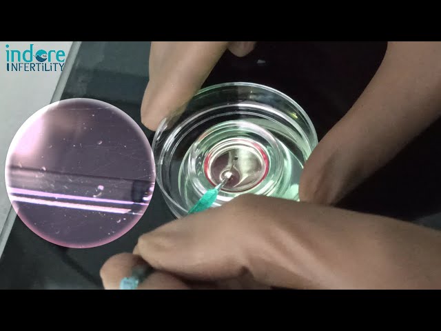 Frozen Embryo Tansfer (FET) - How are Embryos Warmed ( Thaw) in IVF Lab. FET Procedure Step By Step.