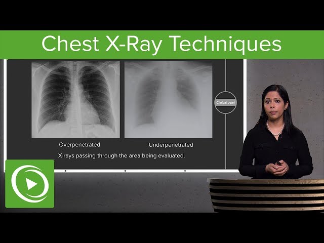 Chest X-Ray Techniques: Inspiration, Penetration, Rotation – Radiology | Lecturio