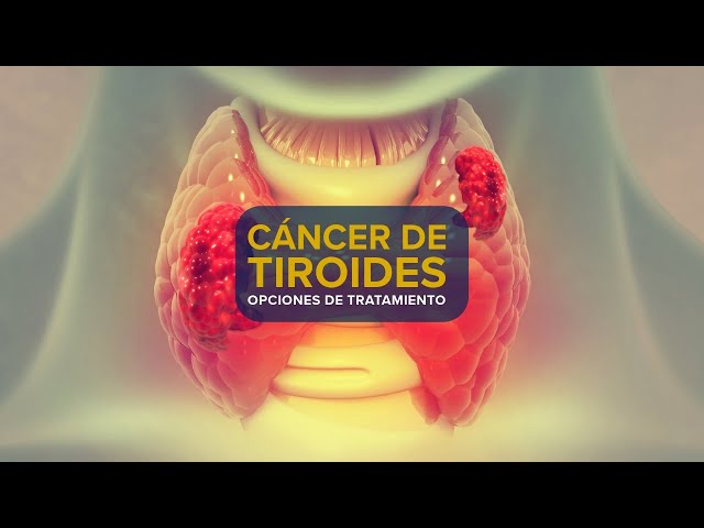 Cáncer de tiroides - Opciones de tratamiento |  UC Davis Health