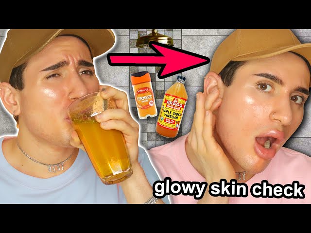 I drank a TUMERIC & APPLE CIDER VINEGAR drink for 2 WEEKS!! (this is what happened to my skin...)