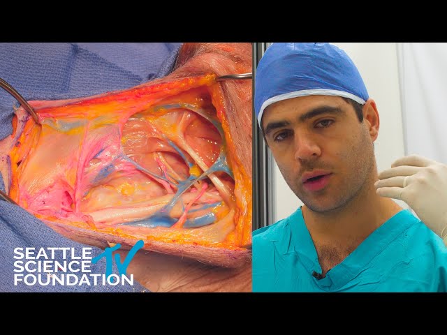 Carotid Endartectomy - Anatomical Landmarks - Matias Costa, M.D.