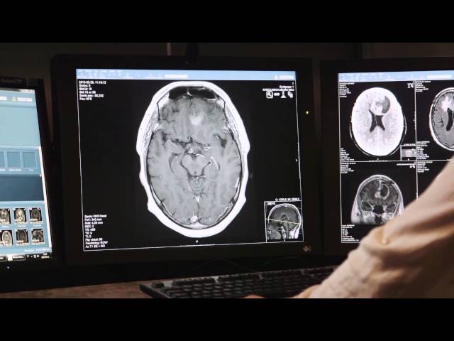 The Human Brain Project SP5: Neuroinformatics