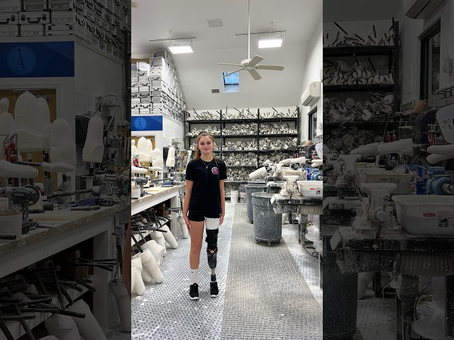 Devan | Cancer Survivor Traveling for Rotationplasty Prosthesis