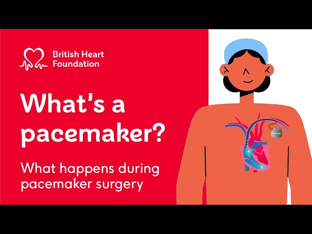 What is a pacemaker and how does it work?