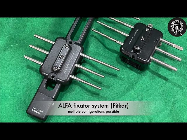 Femur Lengthening: Application of Monolateral Fixator (WARNING - GRAPHIC Video - Surgical Steps)