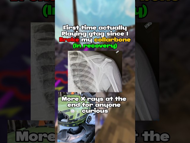 First time actually playing gtag since my crash.