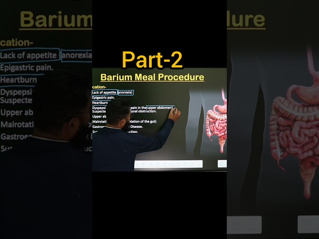Heart burn ❤️‍🔥 Barium Meal Procedure #xray #ct #biology #mri #science