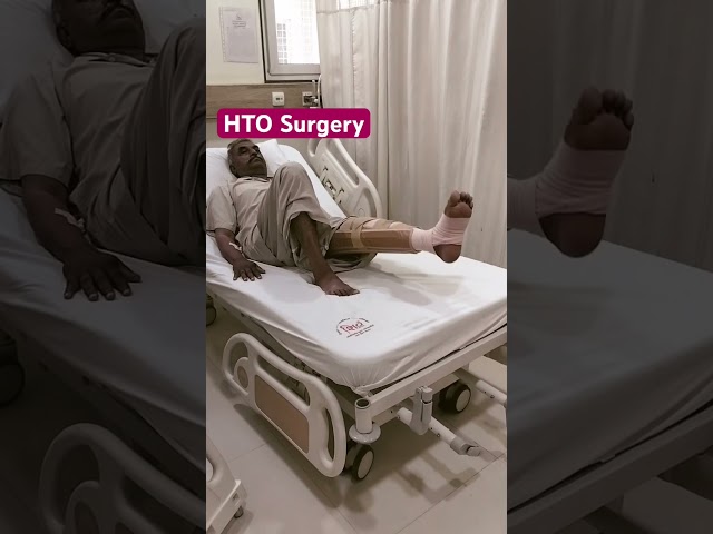 High Tibial Osteotmy | Knee Preservation surgery #HTO #kneepreservationsurgery