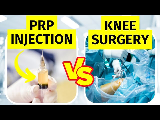 PRP injection or Arthroscopic Surgery for Knee Arthritis?