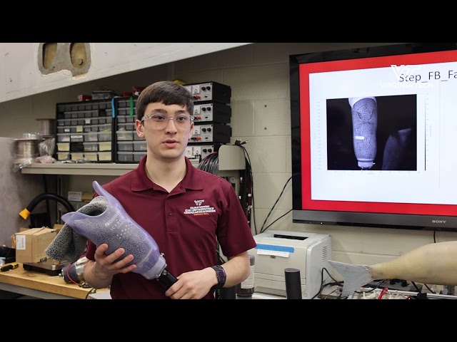 Smart prosthetic sockets aim to improve comfort and performance
