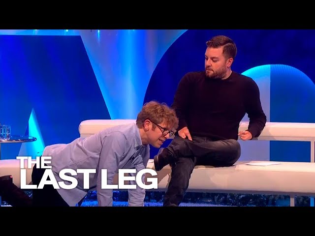 When You Break Your Only Good Leg - The Last Leg