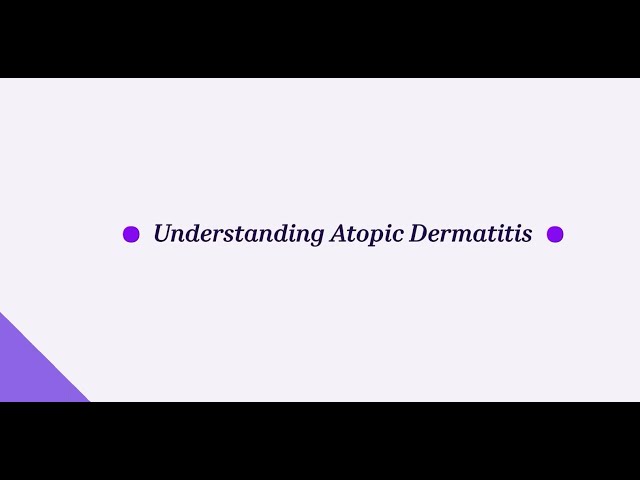Sanofi – Understanding Atopic Dermatitis
