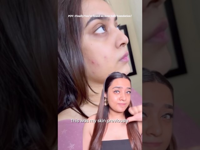 🚨Acne-Prone Skin… Should You REALLY Use This Foundation? 👀 | #shorts #foundation #productreview