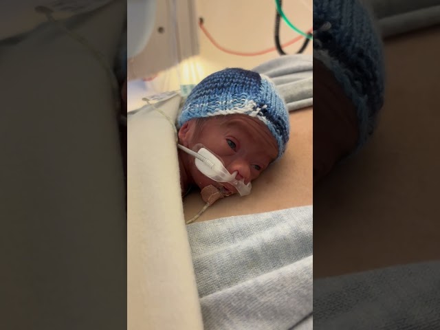 Our little boy Ethan. Born 1 July 2024, 793 grams