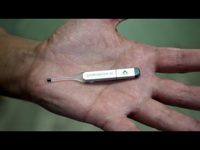 Loop Recorder Implantation in an Outpatient Setting | AHVC