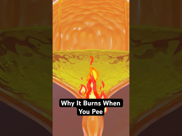 UTI Symptoms: Why It Burns When You Pee