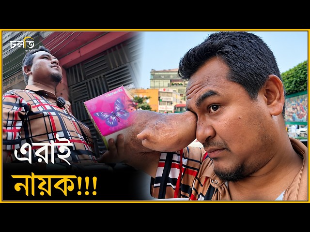 এমন হাত আর দেখেছেন? || চলতি