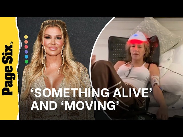 Brandi Glanville’s horrifying ultrasound showed ‘something alive’ amid facial parasite struggles