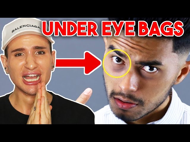 Reacting to a STRAIGHT BOY's TIPS on 'How to Get Rid of Dark Circles and Eye Bags' (they need help)