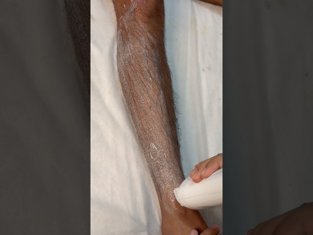 Waxing Gone Wrong 😳 | Wax Didn’t Come Off & Client Felt Pain // rollon wax