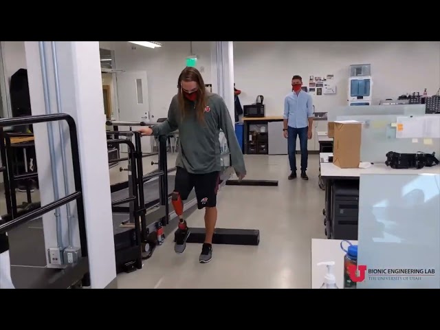 Utah Bionic Leg