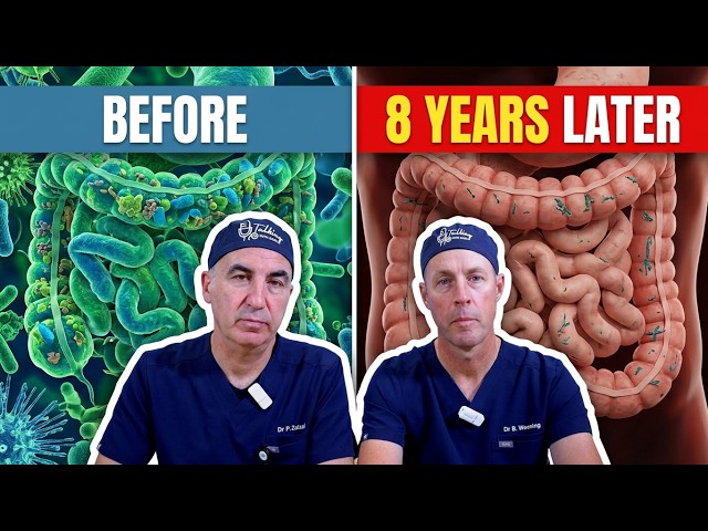 Can One Course Of Antibiotics Change Your Gut for 8 Years? Here's What Doctors Found