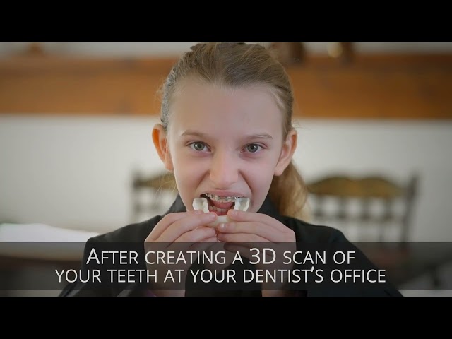 KeyPrint® KeyGuard® | A Revolutionary 3D Printed Custom-Fit Sports Mouthguard