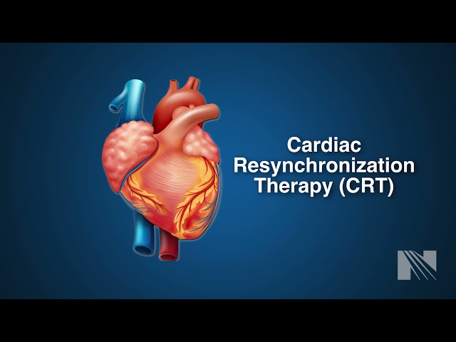 Ventricular Fibrillation Treatment: Cardiac Resyncrhoniation Therapy (CRT)