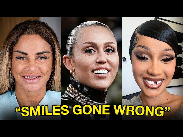 15 Celebrity Veneers Gone Wrong | Before & After 2026