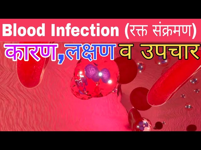 Blood infection in hindi ||  रक्त संक्रमण क्या होता है इसके कारण,लक्षण व उपचार ||