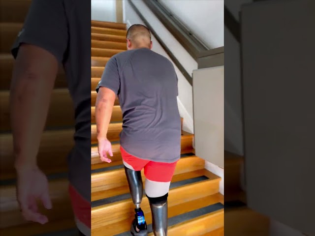 Going Up & Down stairs with prosthetic legs | Bilateral BK Amputee