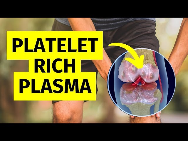 The Truth About PRP Injections For Knee Arthritis: What You Need to Know