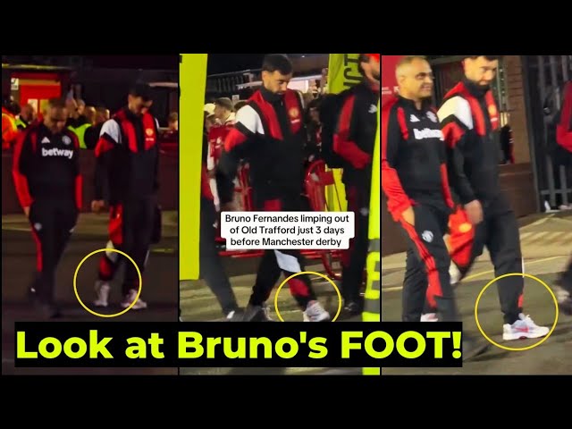 Bruno Fernandes Seen LIMPING with a foot INJURY after Sabah Game with Manchester Derby in 3 Days
